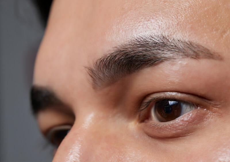 ハリウッドブロウリフト